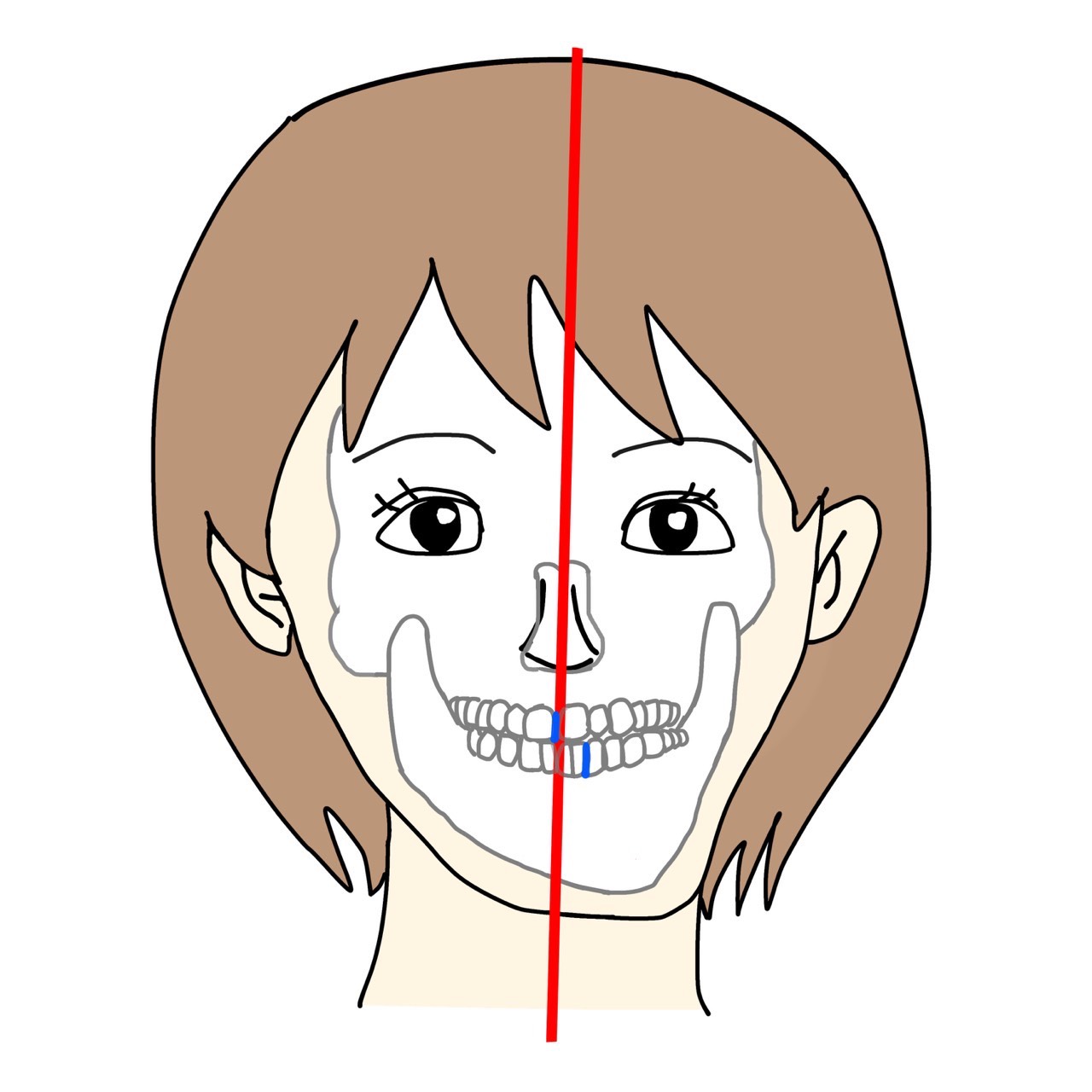 顔面非対称のイラスト