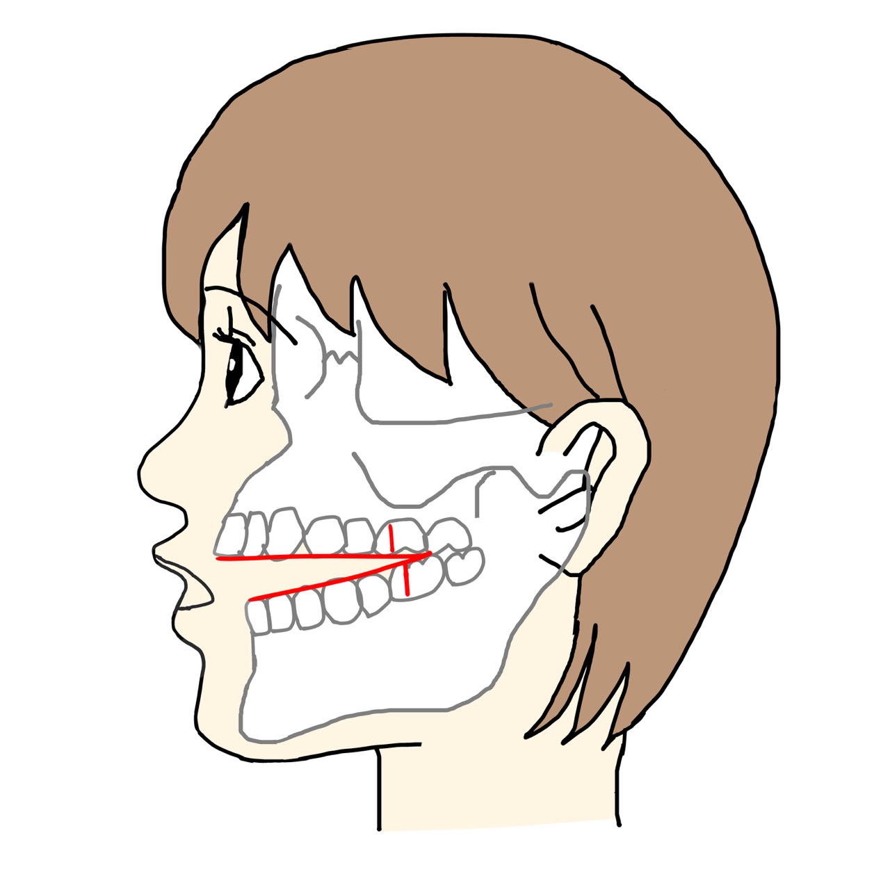 開咬のイラスト