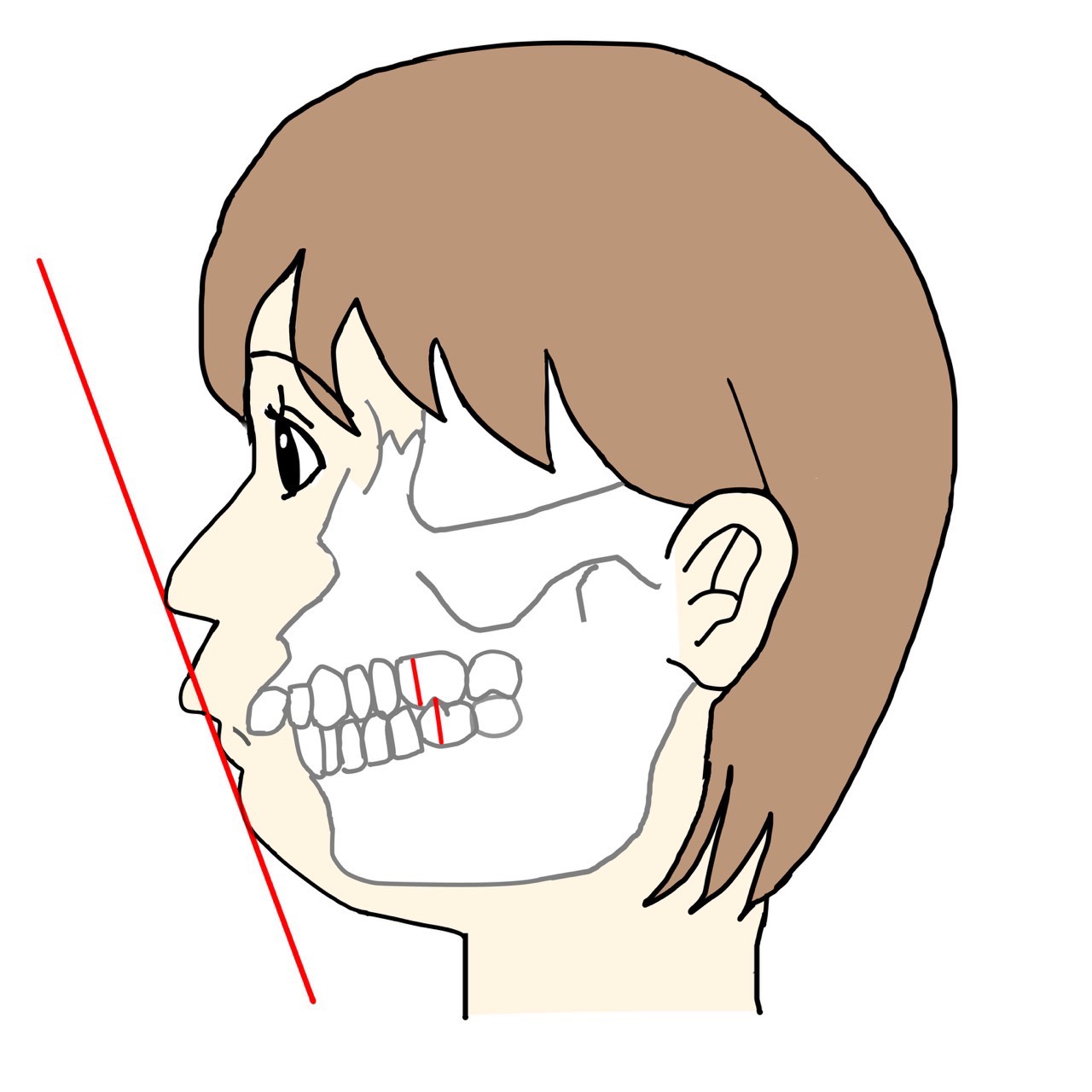 出っ歯・ロゴボのイラスト