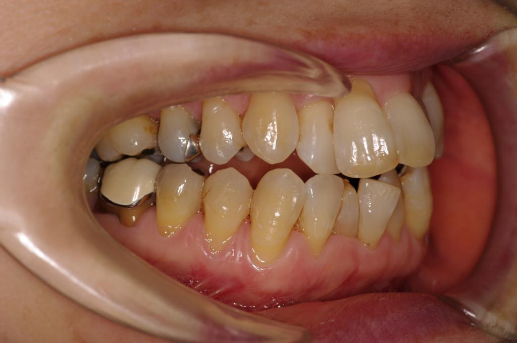 治療前