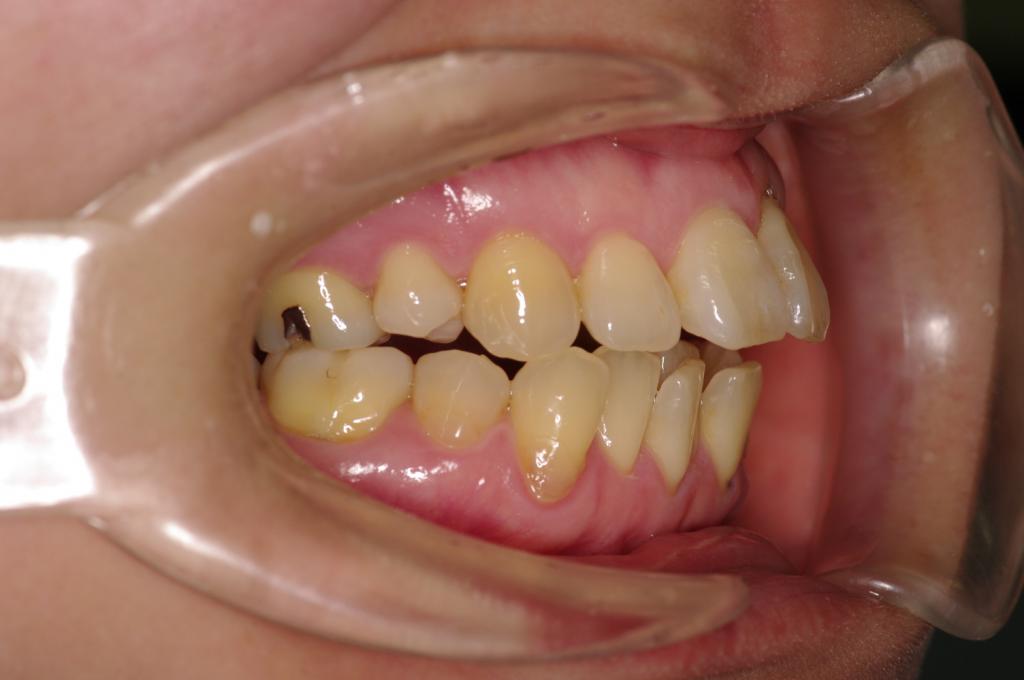治療前