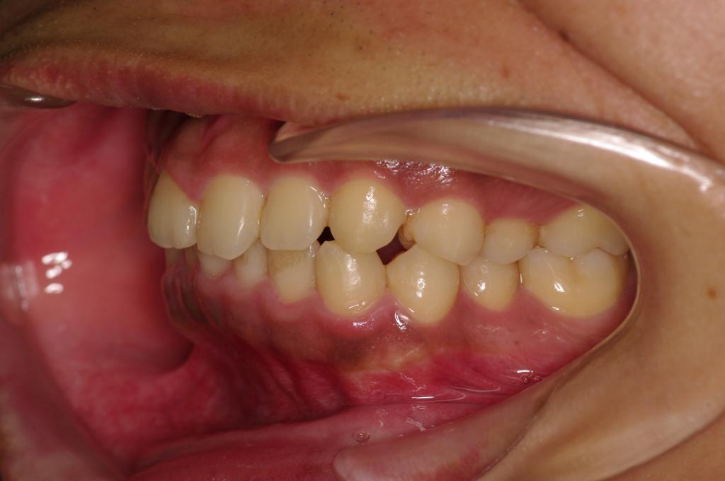 治療前